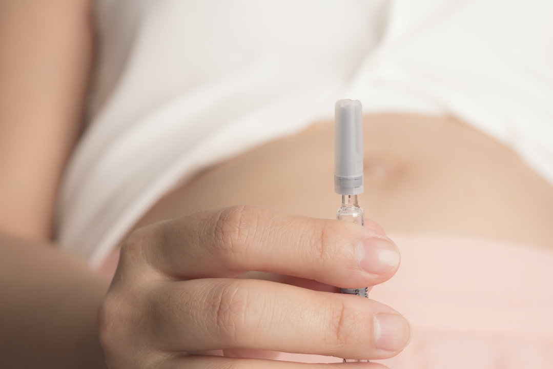 Hormonální stimulace před IVF